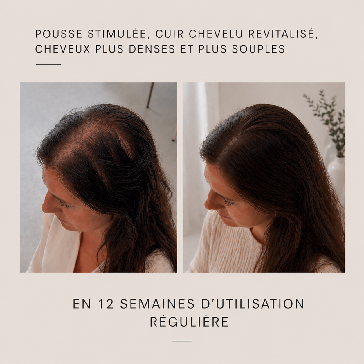 Brosse Stimulante + Bio Sérum Offert